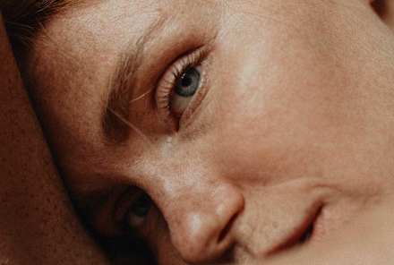 Everything You Need To Know About Dry Eyelids—From Causes To Remedies